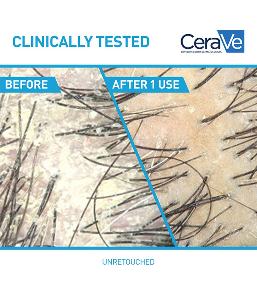 CeraVe Anti-Dandruff Hydrating Shampoo (355ml)