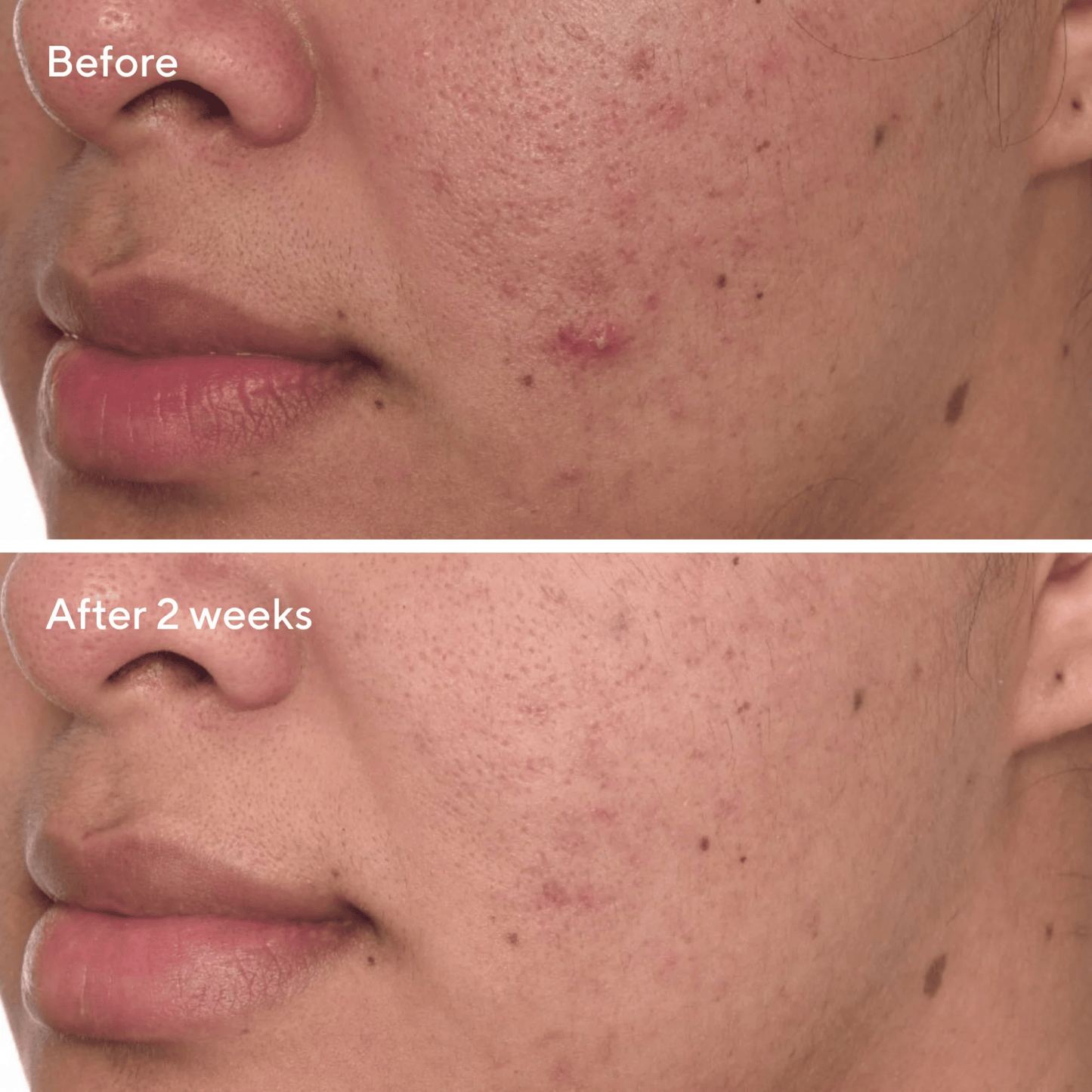 Murad Rapid Dark Spot Correcting Serum (30ml)