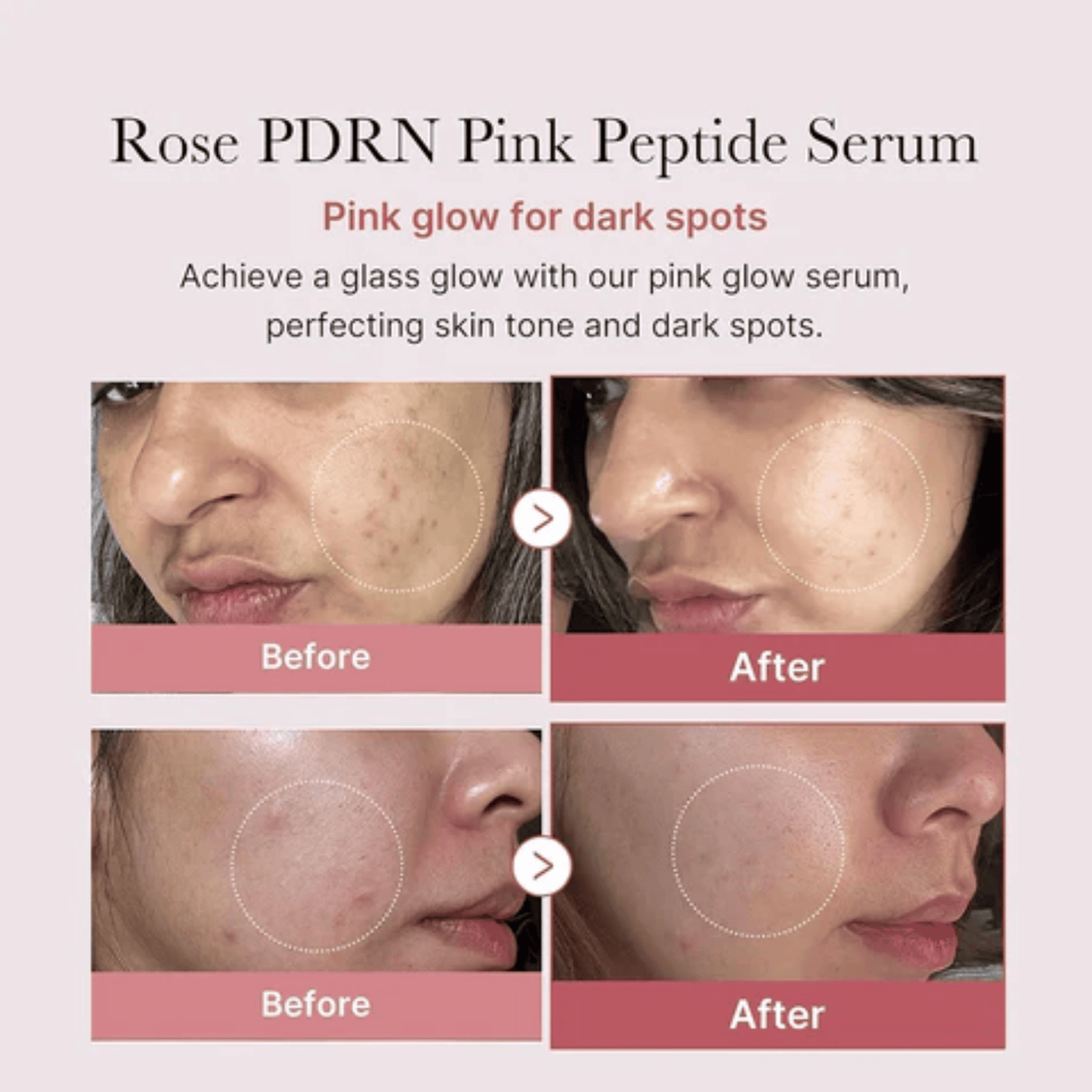 Medicube Pdrn Pink Peptide Serum (30ml)