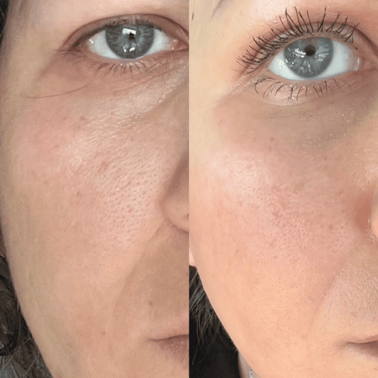 Medicube Zero Pore Cream 2.0