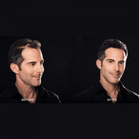 Buy Toppik Hair Building Fibers (12g) USA Variant Online In Pakistan!