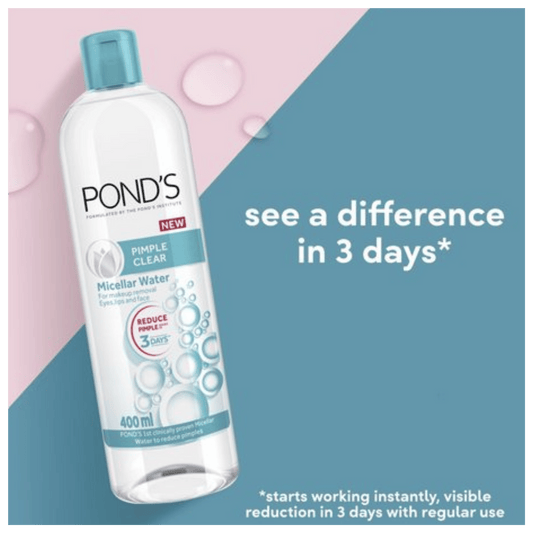 Pond’s Pimple Clear Micellar Water Available Online in Pakistan