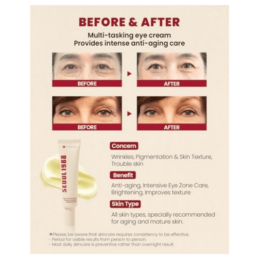 K-Secret Seoul 1988 Eye Cream Retinal Liposome 4% + Fermented Bean (30ml)