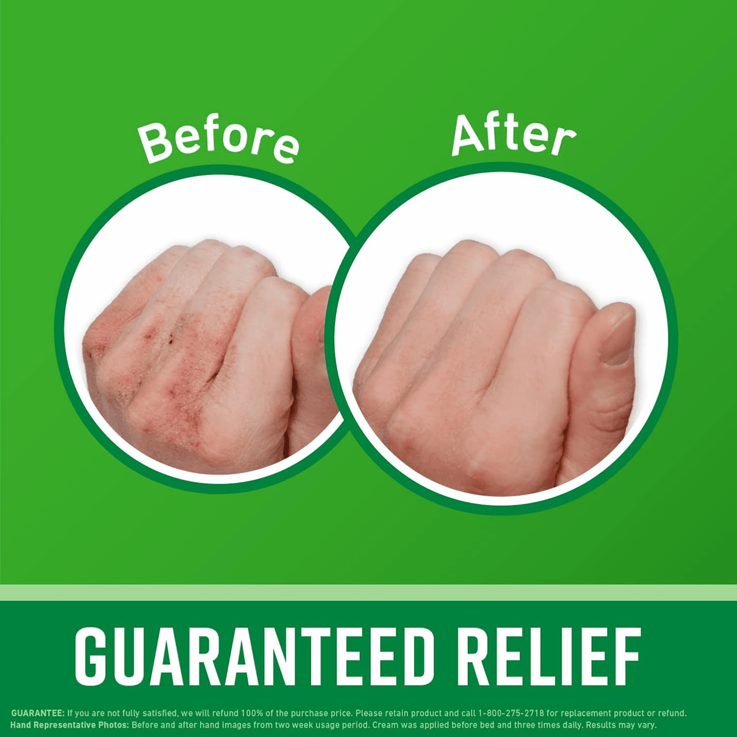 O'KEEFFE'S Working Hands Cream Relieves Extremely Dry Cracked Hands (85g)