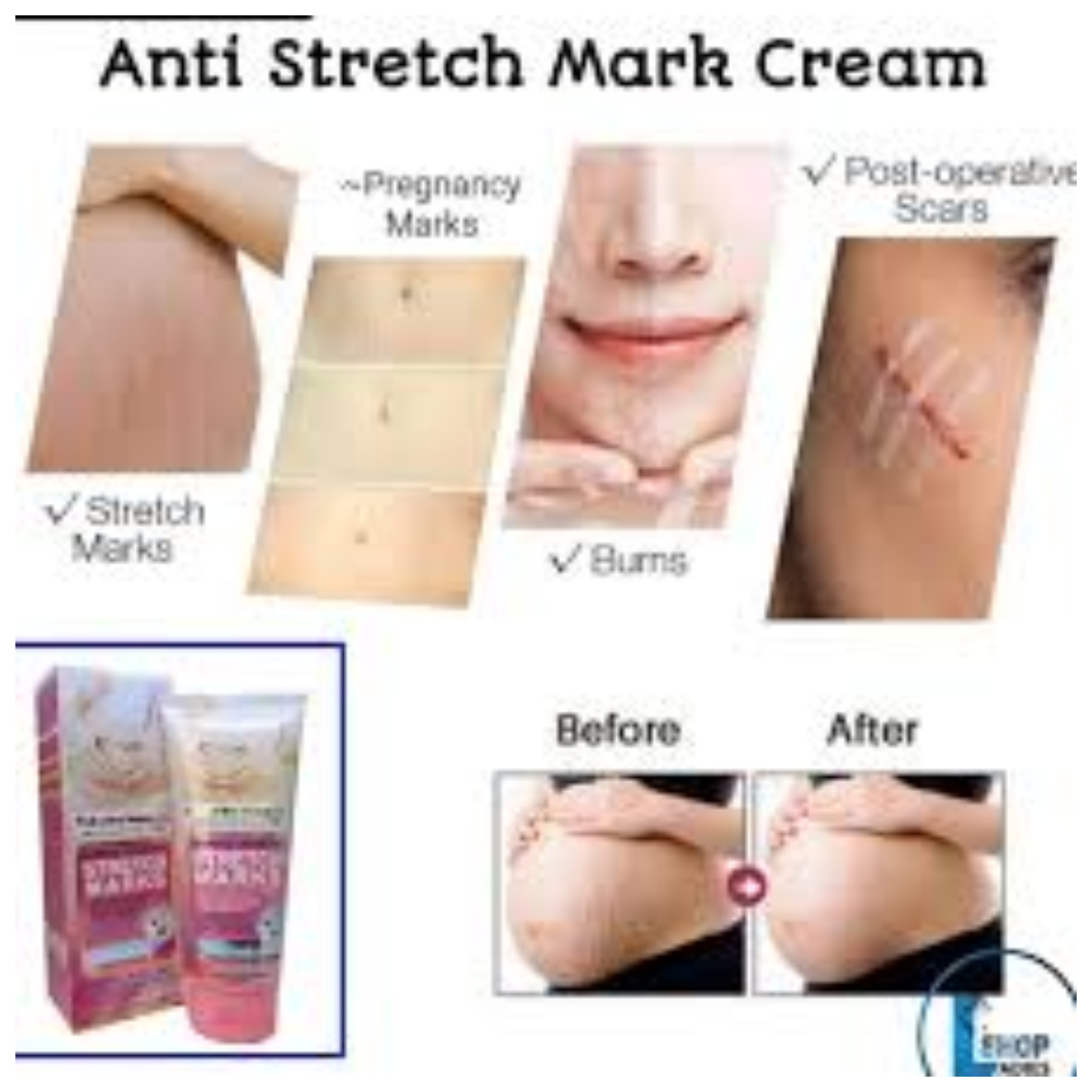 Original
Fruit Of The Wokali Stretch Mark Cream