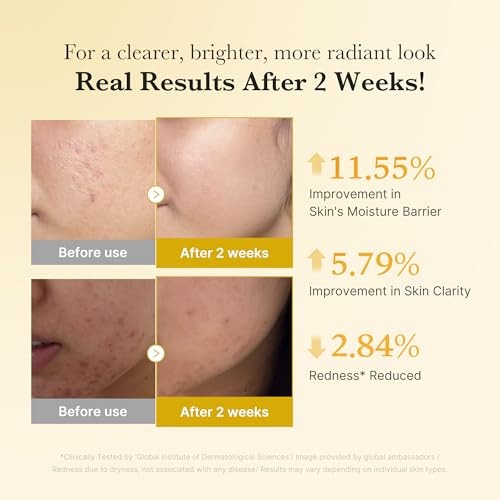 Medicube Kojic Acid Turmeric Niacinamide Serum (30ml)