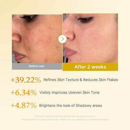 Medicube Kojic Acid Turmeric Resurfacing Toner (250ml)
