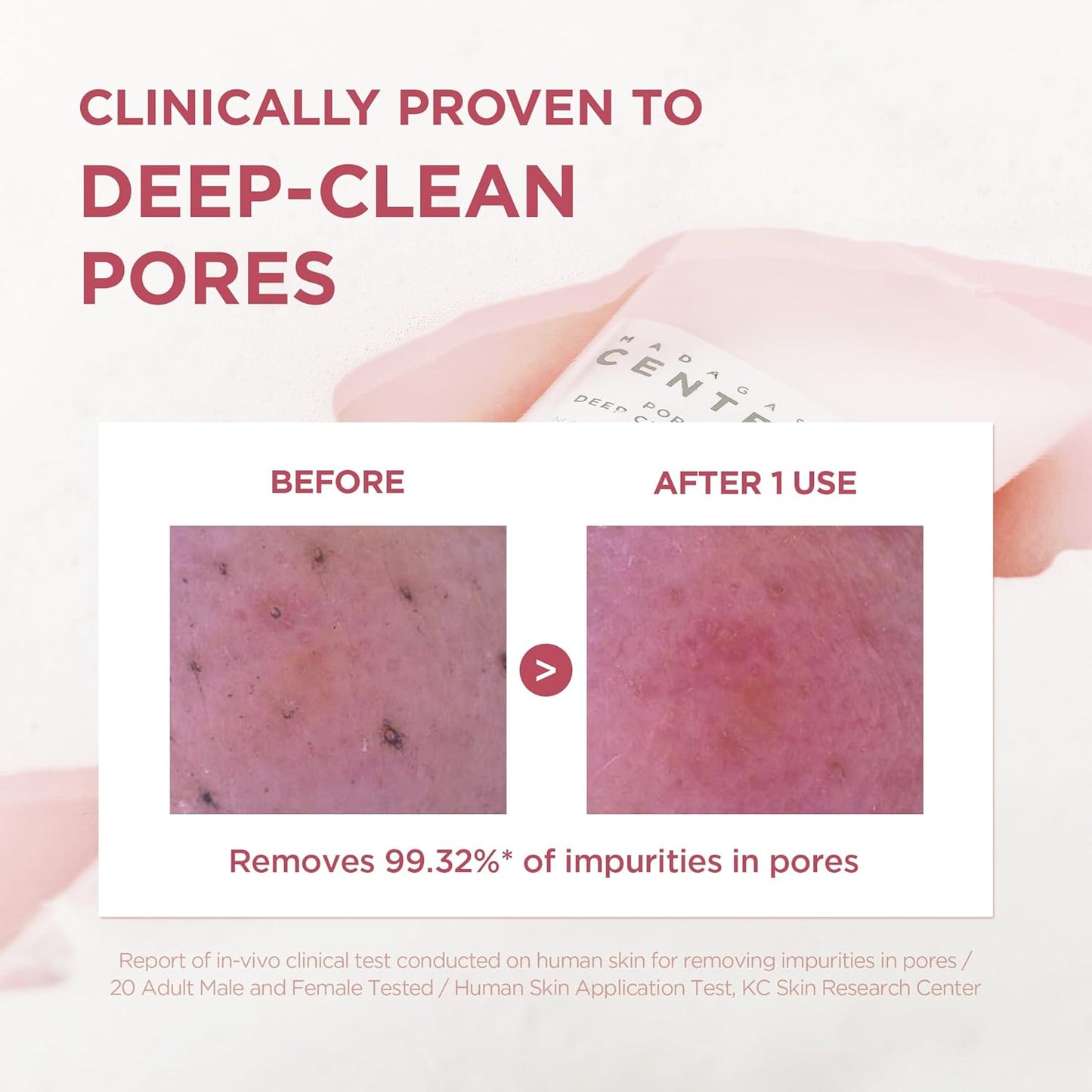 Skin1004 Madagascar Centella Poremizing Deep Cleansing Foam (125ml)
