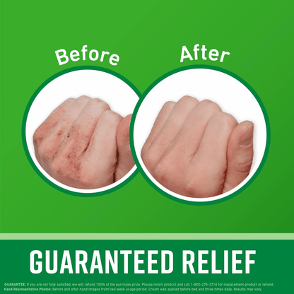 O'KEEFFE'S Working Hands Cream Relieves Extremely Dry Cracked Hands (85g)