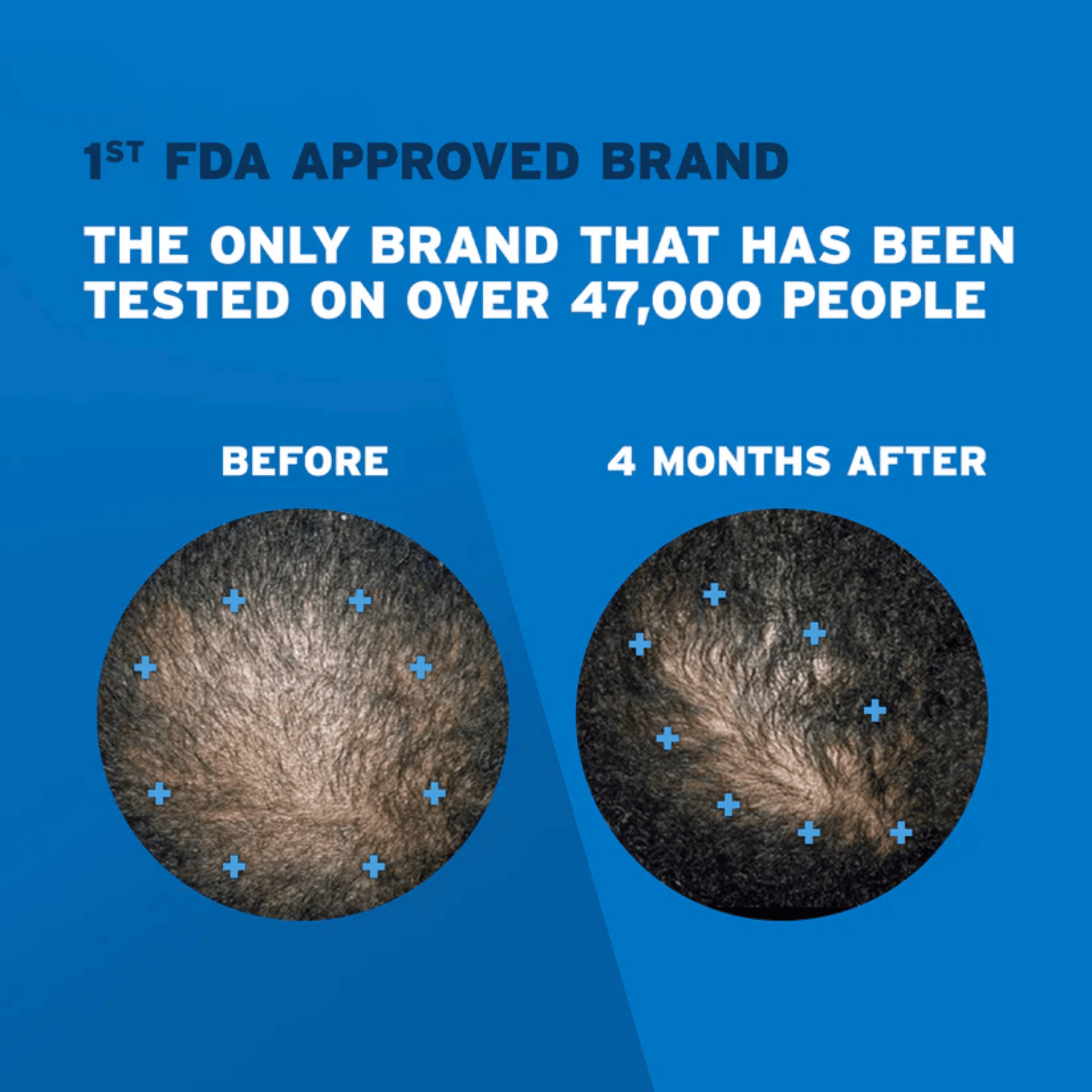 Shop Rogaine Men's Hair Regrowth Topical Solution Online in Pakistan