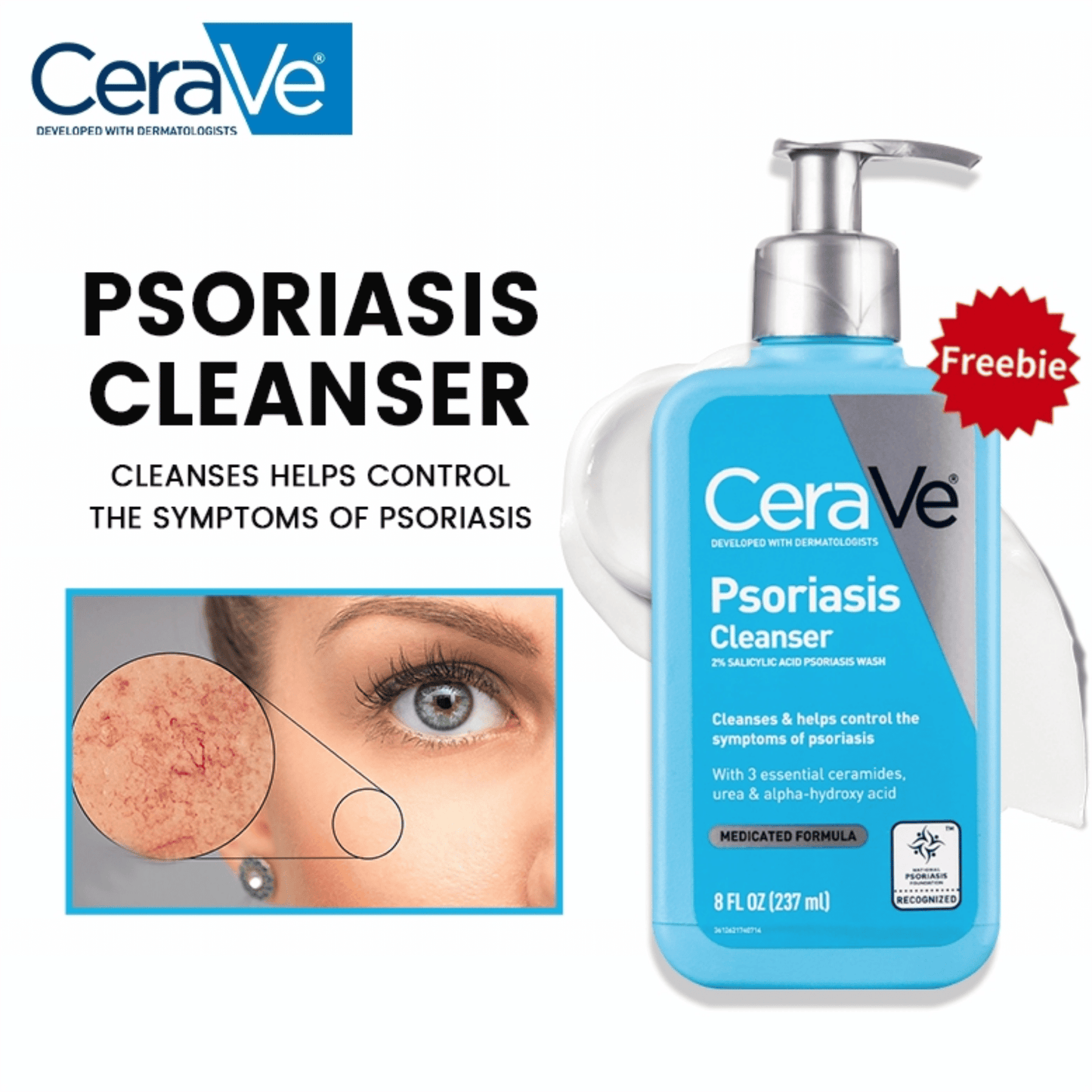 CeraVe Psoriasis Cleanser with 2% Salicylic Acid Psoriasis Wash (237ml)