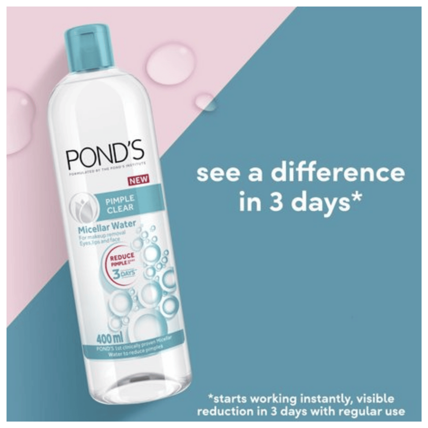 Pond’s Pimple Clear Micellar Water Available Online in Pakistan