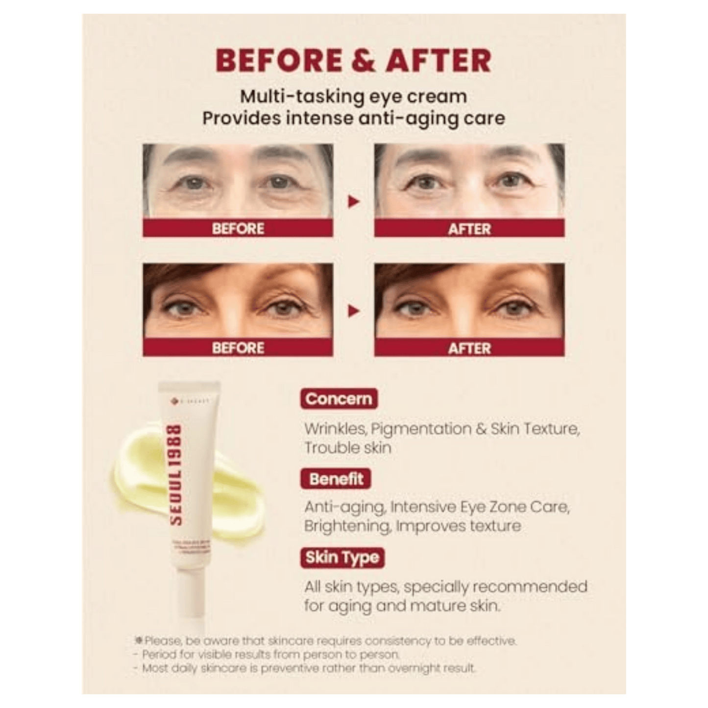 K-Secret Seoul 1988 Eye Cream Retinal Liposome 4% + Fermented Bean (30ml)