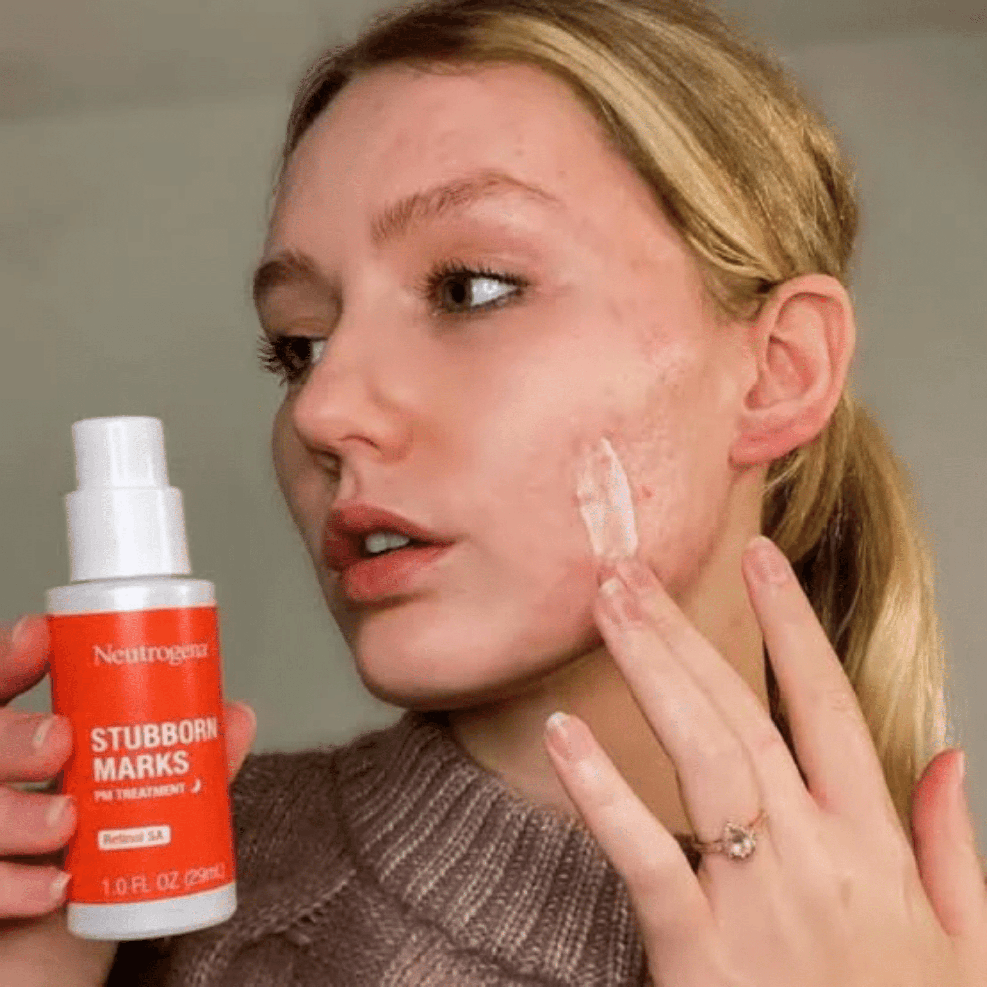 NEutrogena Stubborn Acne